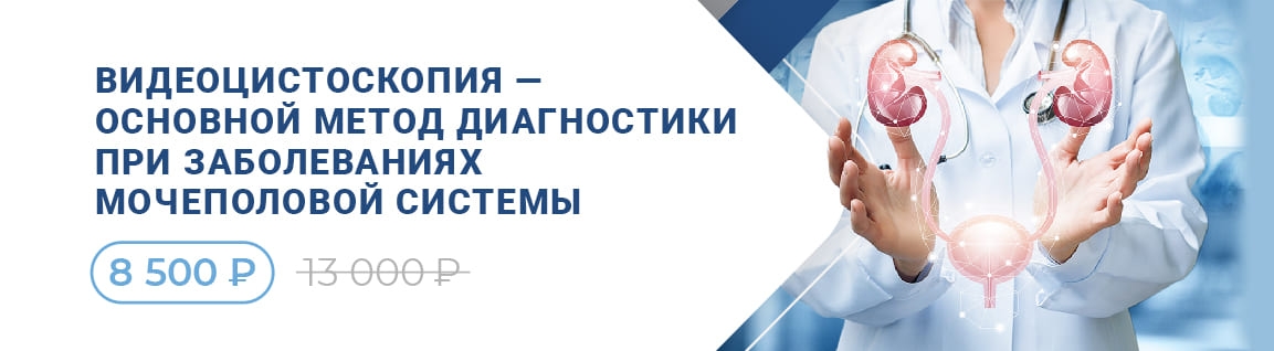 Видеоцистоскопия